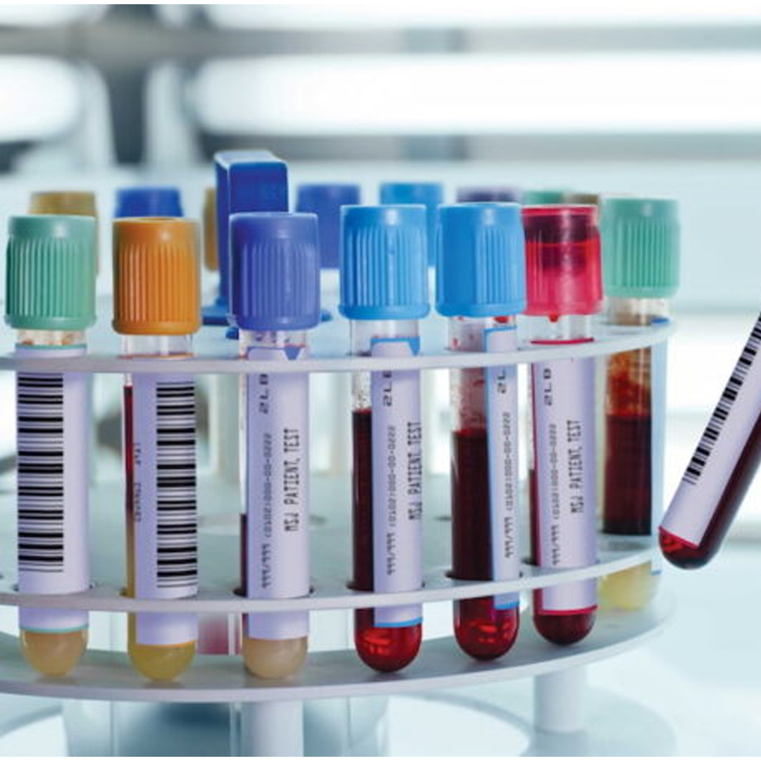 Blood Collection available in online  pharmacy qatar, doha 